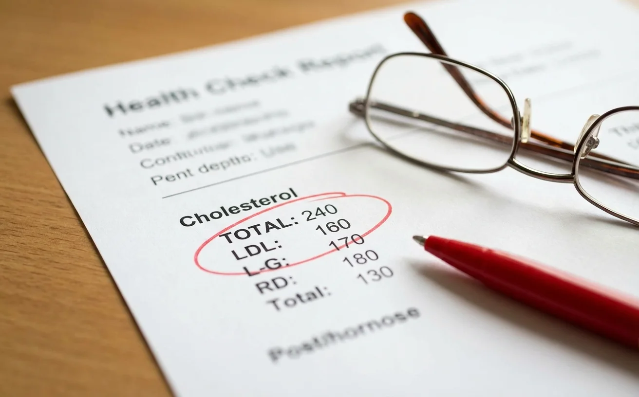 健康檢查膽固醇數值報告